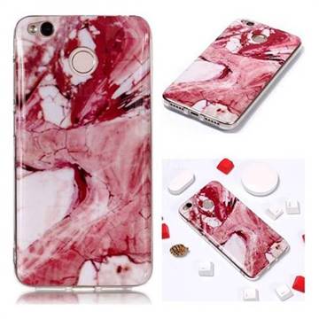 Pork Belly Soft TPU Marble Pattern Phone Case for Xiaomi Redmi 4 (4X)