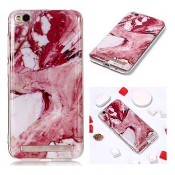 Pork Belly Soft TPU Marble Pattern Phone Case for Xiaomi Redmi 5A
