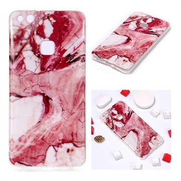 Pork Belly Soft TPU Marble Pattern Phone Case for Huawei P10 Lite P10Lite