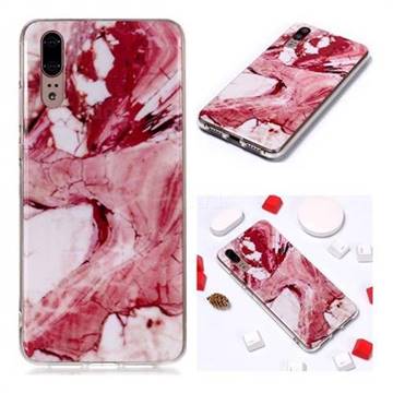 Pork Belly Soft TPU Marble Pattern Phone Case for Huawei P20
